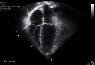 Echocardiogramwebsite